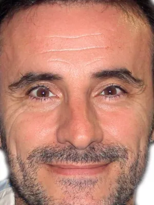 Claudio Serrano
